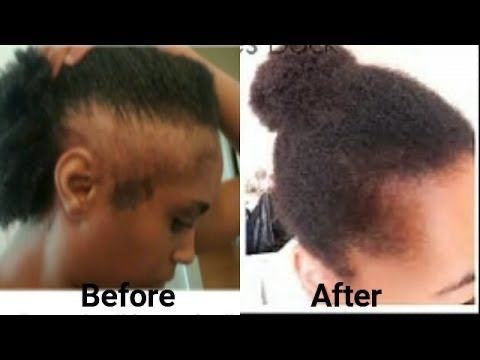JAMIACAN BLACK CASTOR OIL HAIR FOOD